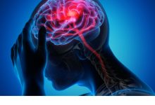 brain injury awareness month encephalitis